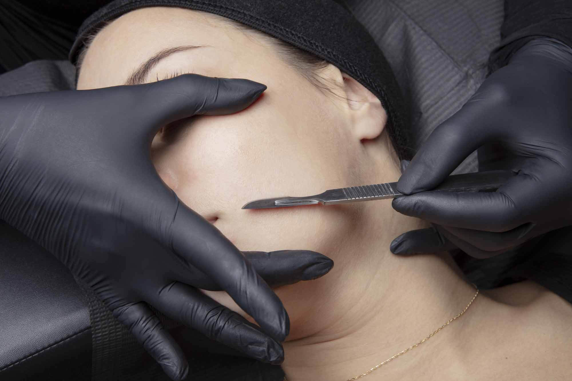 Advanced Dermaplaning Training